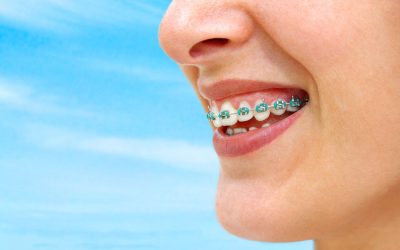 Repair Your Misaligned Teeth With Braces In Medina OH